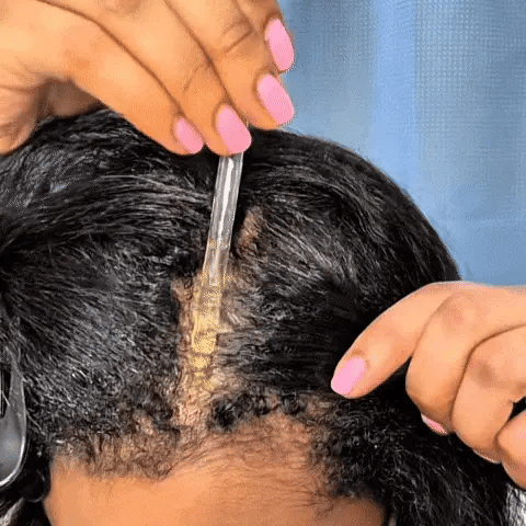 Advanced Batana Oil Hair Regrowth Therapy | Reverse Thinning Hair & Receding Hairline🌱