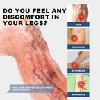 Herbal Varicose Veins Cream, Leg Relief Care🦵